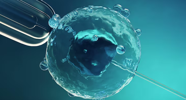 In Vitro Fertilization
