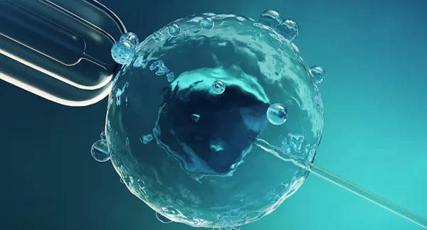 In Vitro Fertilization
