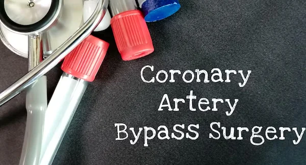 Heart Bypass Surgery CABG
