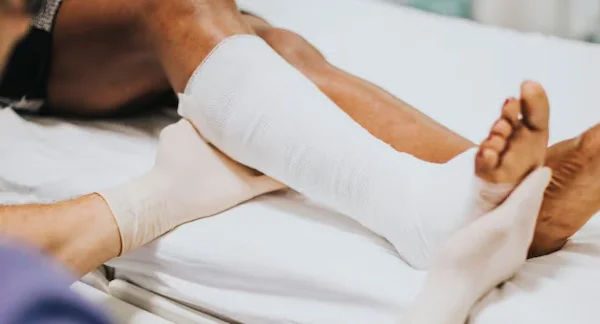 Fracture Care Casting to Surgery Options