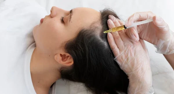 PRP for Hair Loss
